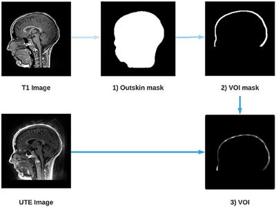 Automated Electrodes Detection During Simultaneous EEG/fMRI